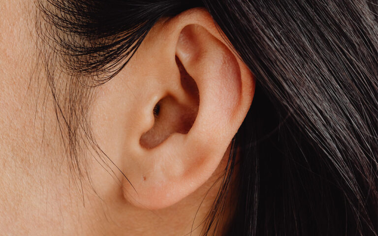 ¿Qué es timpanoplastia y por qué se realiza?